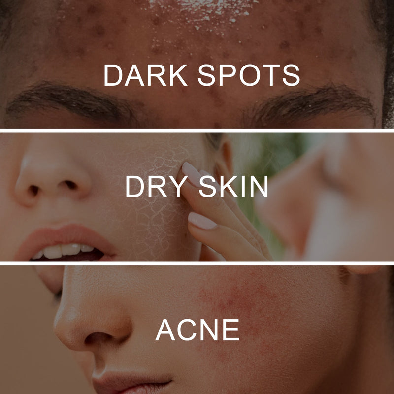 Retinol Pigment Correcting Spray, Lightening Spots Moisturizing Whitening Skin Care Spray
