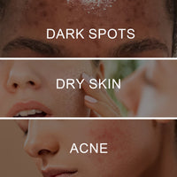 West&Month Retinol Pigment Correcting Spray, Lightening Spots Moisturizing Whitening Skin Care Spray