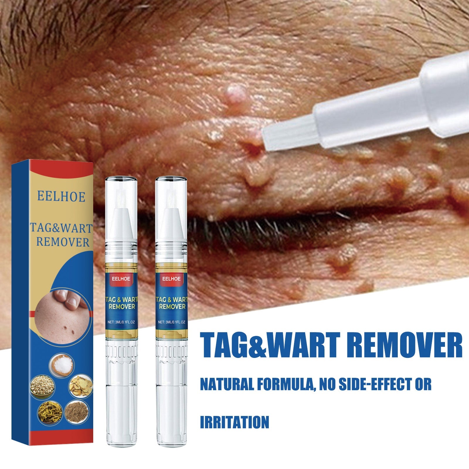 Skin Kayo Pen Gentle Body Tag Remover Cleansing Skin Care Pen