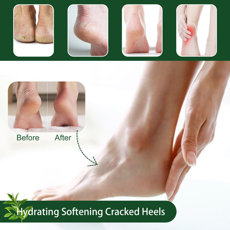 Tea Tree Oil Foot Cream Repair Heel Crack Anti-Dry Crack Skin Moisturizing Foot Care Cream