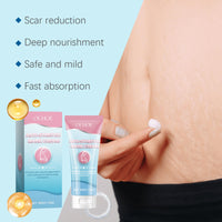 Ouhoe Pregnancy Care Cream, Repair Postpartum Skin Fine Lines Moisturizing Smooth Skin Whitening Pregnancy Care Cream
