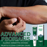 Wet Search Herbal Cream, Skin Cream Moisturizes, Hydrates And Reduces Itching Herbal Cream