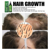 South Moon Hair Care Spray Nourishing And Nourishing Hair Massage Repair Hair And Scalp Care Solution