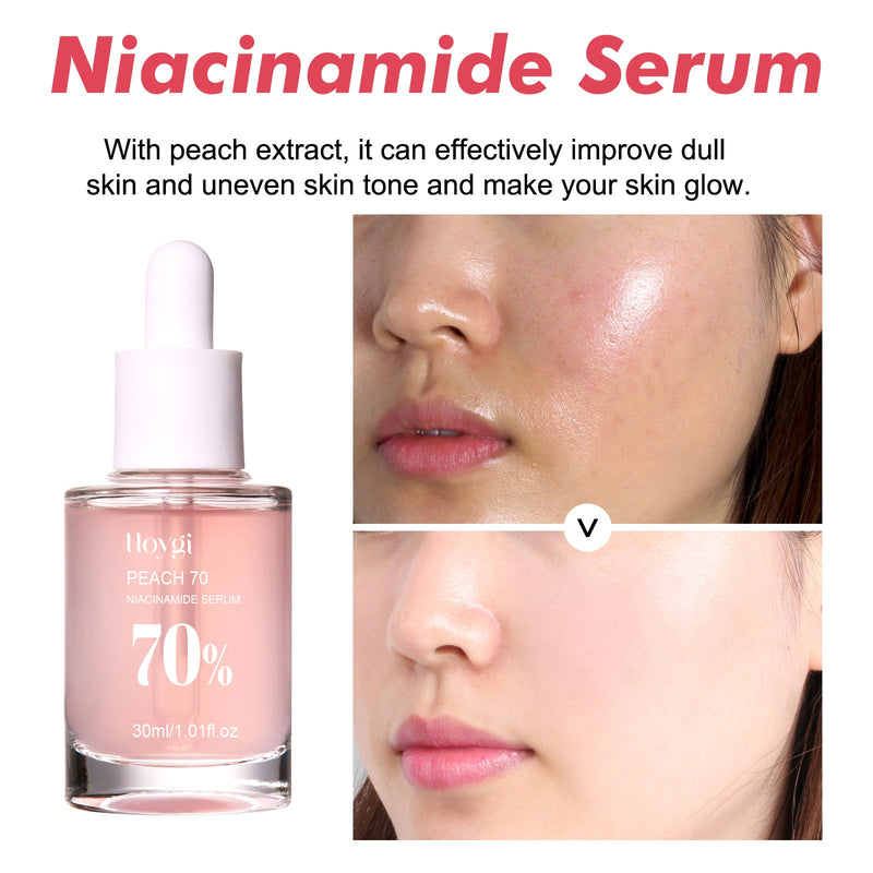 Hoygi Nicotinamide Essence Tights And Moisturizes Pores, Lighens Acne Marks And Spots, Moisturizes And Brighens Skin