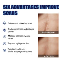 Scar Repair Cream Lighten Scar Pregnancy Surgery Scar Repair Skin Smooth Skin Care Cream