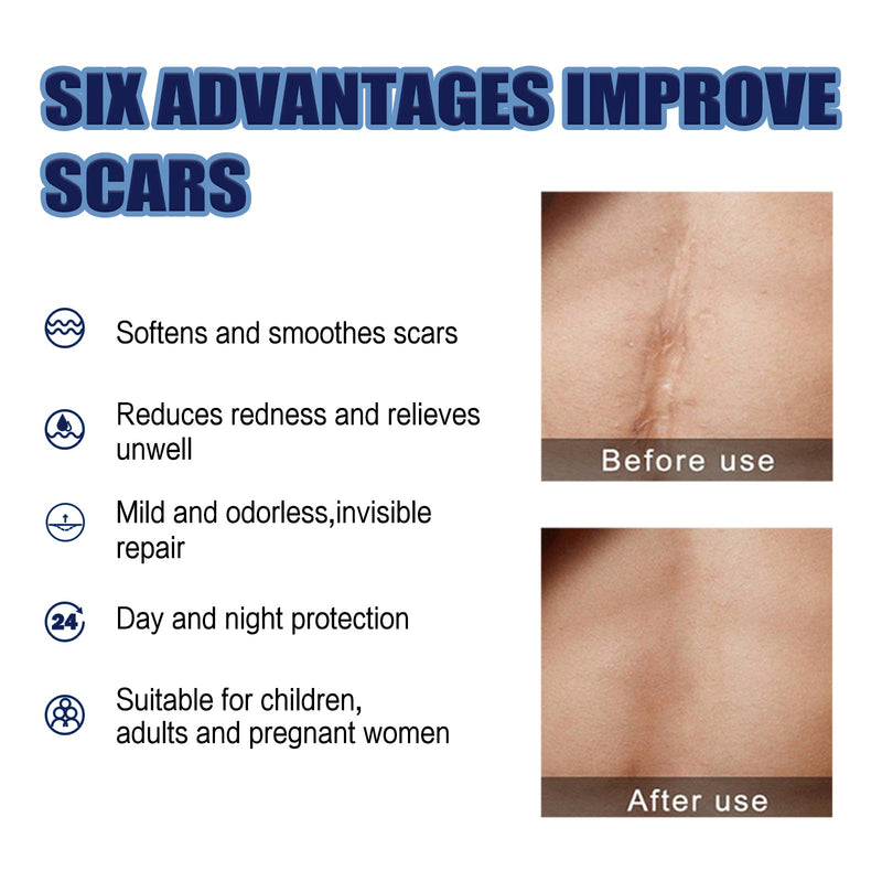 Scar Repair Cream Lighten Scar Pregnancy Surgery Scar Repair Skin Smooth Skin Care Cream