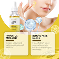 Face Essence Repair Acne Muscle Acne Closing Gentle Cleansing Face Skin Face Essence