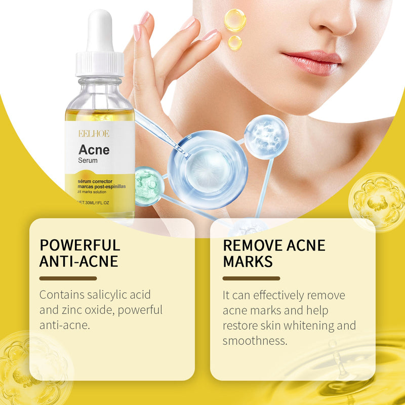 Face Essence Repair Acne Muscle Acne Closing Gentle Cleansing Face Skin Face Essence