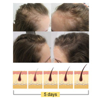 Ginger Dense Hair Soap, Moisturizes Hair Ends And Roots Cleansing Scalp Hair Care Shampoo Soap