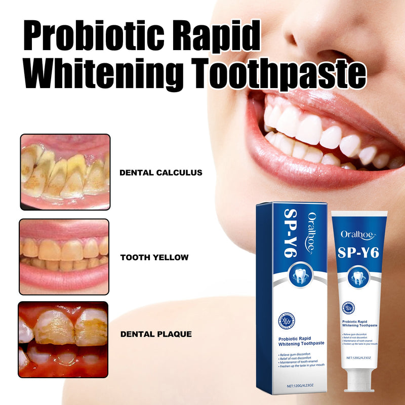 Probiotic Rapid Whitening Toothpaste, Fresh Breath To Remove Stains And Tartar White Teeth To Remove Odor And Beautiful Teeth