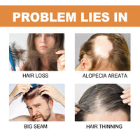 EELHOE Mypa Ampoule, Strengthen And Repair Hair, Prevent Hair Loss, Strengthen Hair Root And Thicken Hair And Scalp Massage Solution