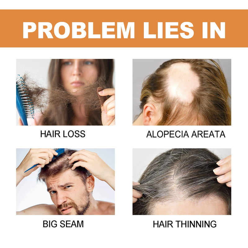 EELHOE Mypa Ampoule, Strengthen And Repair Hair, Prevent Hair Loss, Strengthen Hair Root And Thicken Hair And Scalp Massage Solution