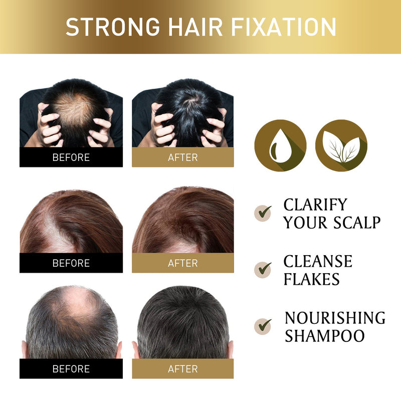 Hair Regrowth Exfoliate Scrub, Clean Dandruff Refreshing Soft Moist Hair, Hair Scrub