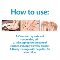 Nail Repair Solution, Repair Hands And Feet Gray Nails Rote Nails Thickening Toenails Clean And Bright Nail Care Solution
