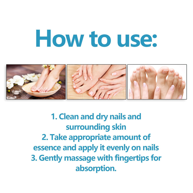Nail Repair Solution, Repair Hands And Feet Gray Nails Rote Nails Thickening Toenails Clean And Bright Nail Care Solution