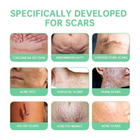 Activated Skin Repairs Spray, Fade Scar Pregnancy Surgery Scar Moisturizing Repair Smooth Skin Care Spray