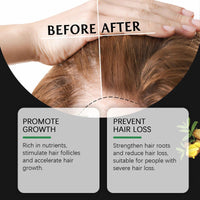 West&Month Batana Hair Care Essential Oil Softens Hair, Nourishes And Hydrates Hydrating Hair Care Oil