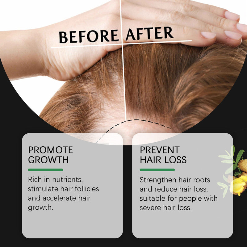 West&Month Batana Hair Care Essential Oil Softens Hair, Nourishes And Hydrates Hydrating Hair Care Oil