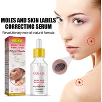 EELHOE Wart Essence Removes Dark Moles Flesh Moles Repair Skin Neck Flesh Grains Flat Especially Corns Remove Warts