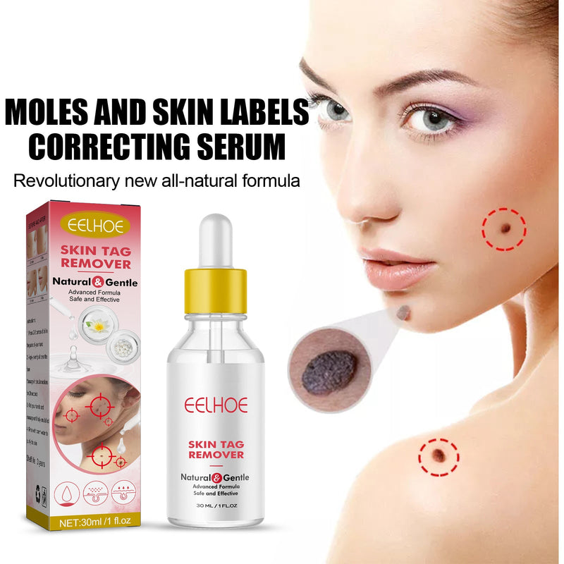 EELHOE Wart Essence Removes Dark Moles Flesh Moles Repair Skin Neck Flesh Grains Flat Especially Corns Remove Warts