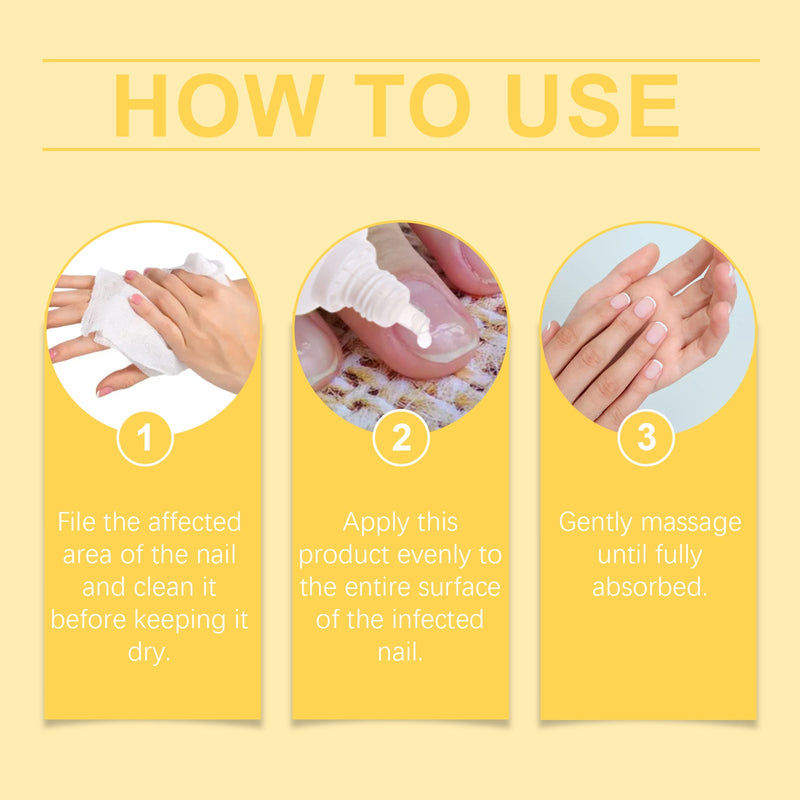 Bee Venom Nail Care Essence Foot Gray Nails Brightening Nails Rotten Nails Soft Nails Nail Care