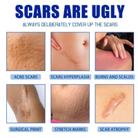 Jaysuing Scar Cream, Fade Scars Smooth And Firming Skin Repair Cream