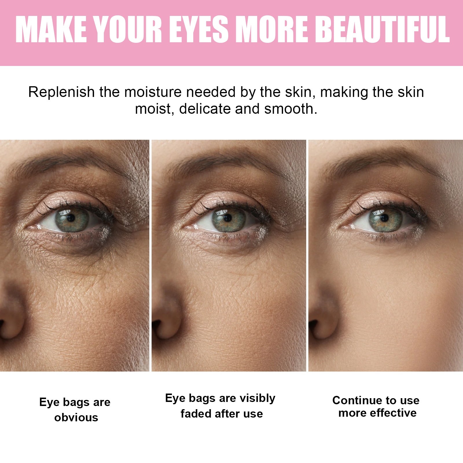Sakura Dark Circle Eye Cream, Reduce Dark Eye Bags Around The Eyes Dull Brighten Moist Delicate Tight