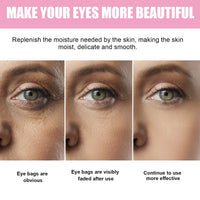 Sakura Dark Circle Eye Cream, Reduce Dark Eye Bags Around The Eyes Dull Brighten Moist Delicate Tight
