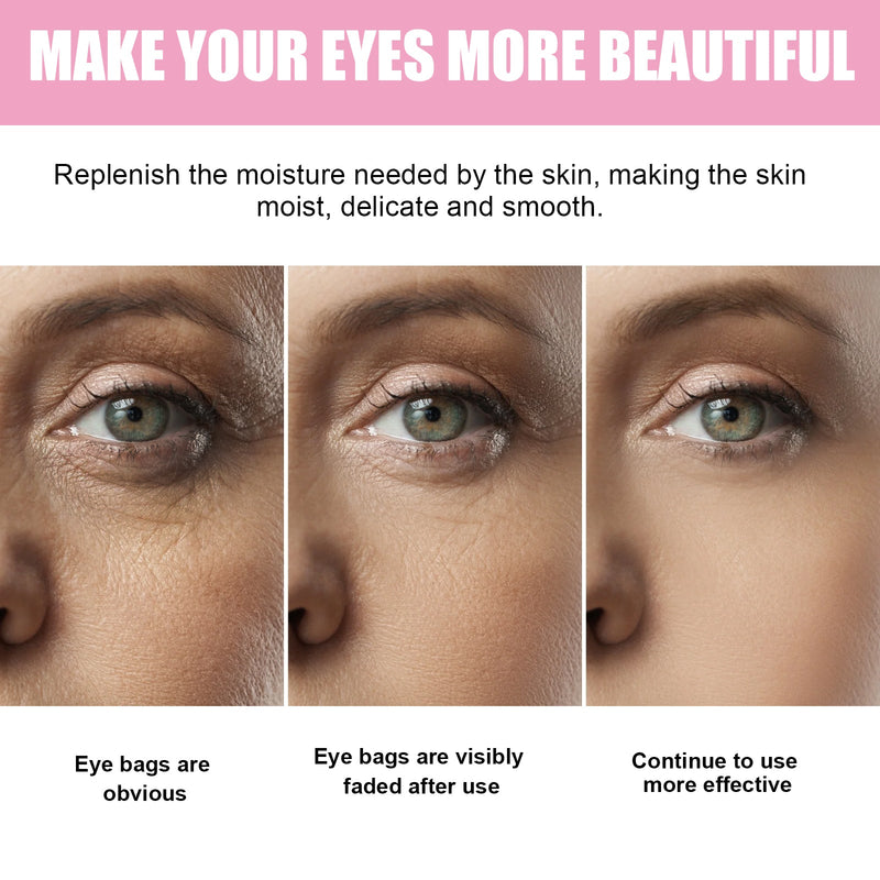 Sakura Dark Circle Eye Cream, Reduce Dark Eye Bags Around The Eyes Dull Brighten Moist Delicate Tight