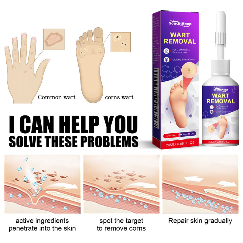 South Moon Remove Chicken Eye Lotion Extra Clear Remove Corns Skin Care Chicken Calluses Foot Pad Gram Warts
