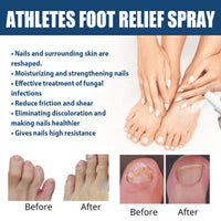 South Moon Athletes Foot Relief Spray, Relieve Foot Sweat Foot Itching Peeling Gray Nails Foot Odor Moisturizing Care Spray