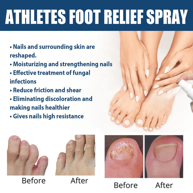 South Moon Athletes Foot Relief Spray, Relieve Foot Sweat Foot Itching Peeling Gray Nails Foot Odor Moisturizing Care Spray