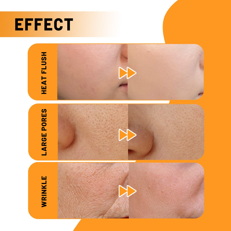 Face Essence Reduces Fine Lines, Brightening Facial Tone, Moisturizing And Hydrating Skin Essence