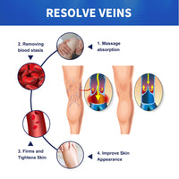 South Moon Vein Massage Varicose Cream Repair Earthworm Legs To Relieve Leg Blood Vessel Bulge And Varicoidea