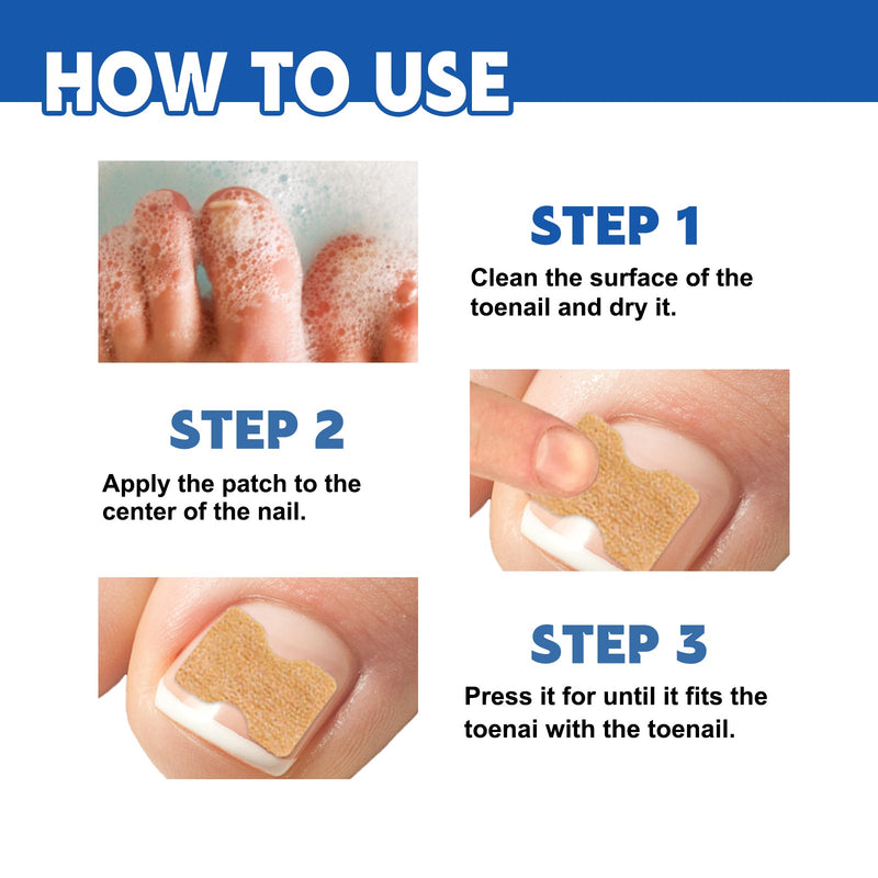 Nail Seam Care Patch, Repair Thickening Gray Nail Soft Nail Correction Nail Seam Patch