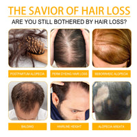 EELHOE Biotin Hair Growth Spray, Strong Anti-Rip Repair Hair Care And Root Stabilization Spray