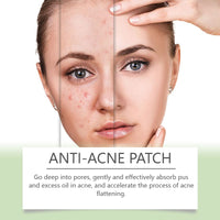 Anti-Acne Patch, Gentle Cleansing Helps Relieve Facial Blemishes Appearance Concealer Breathable Facial Care Patch