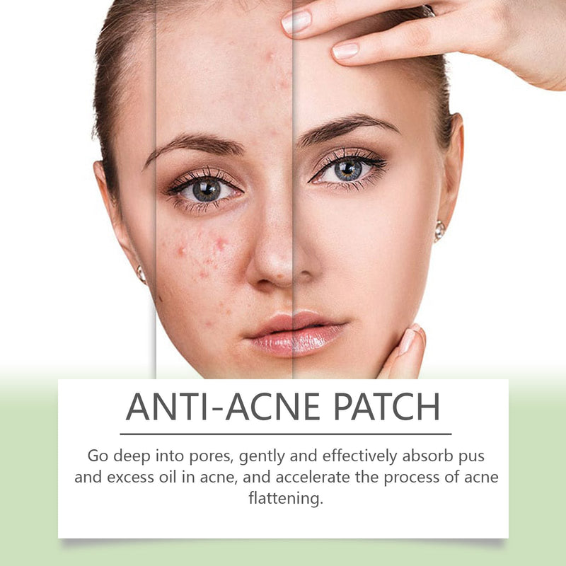 Anti-Acne Patch, Gentle Cleansing Helps Relieve Facial Blemishes Appearance Concealer Breathable Facial Care Patch