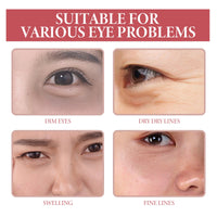Dark Circle Serum, Wrinkles Pouch Filling Water Moist Firming Eye Week Skin Essence