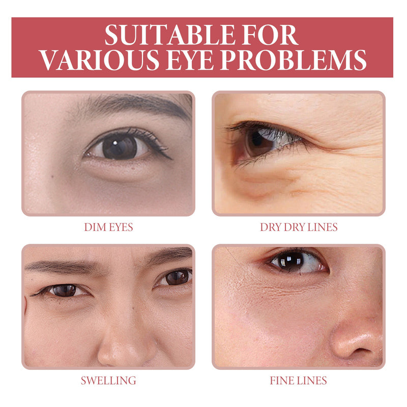Dark Circle Serum, Wrinkles Pouch Filling Water Moist Firming Eye Week Skin Essence