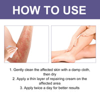 3 Days Aati Fungal Rash Cream, Repair Skin Barrier Soothe Moss Redness And Itchiness Moisturizing Skin Care Cream