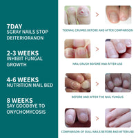 Toenail Repair Solution Smoothing Nail And Hand, Foot And Nail Cleansing And Nourishing Repair Solution