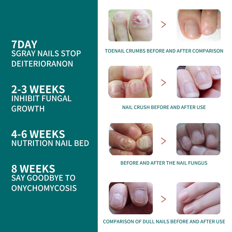 Toenail Repair Solution Smoothing Nail And Hand, Foot And Nail Cleansing And Nourishing Repair Solution