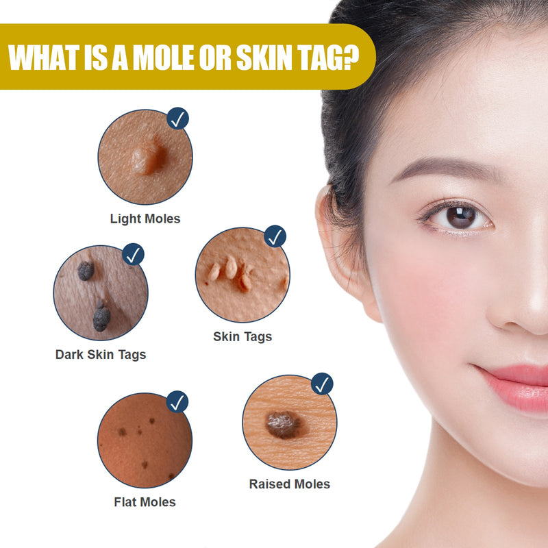 EELHOE Wart Essence Removes Dark Moles Flesh Moles Repair Skin Neck Flesh Grains Flat Especially Corns Remove Warts