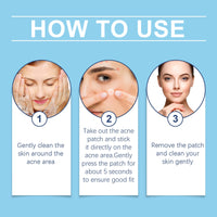 Day And Night Acne Cover Face Acne Patch Comfortably Repair Skin Oil Control Cover Acne Patch