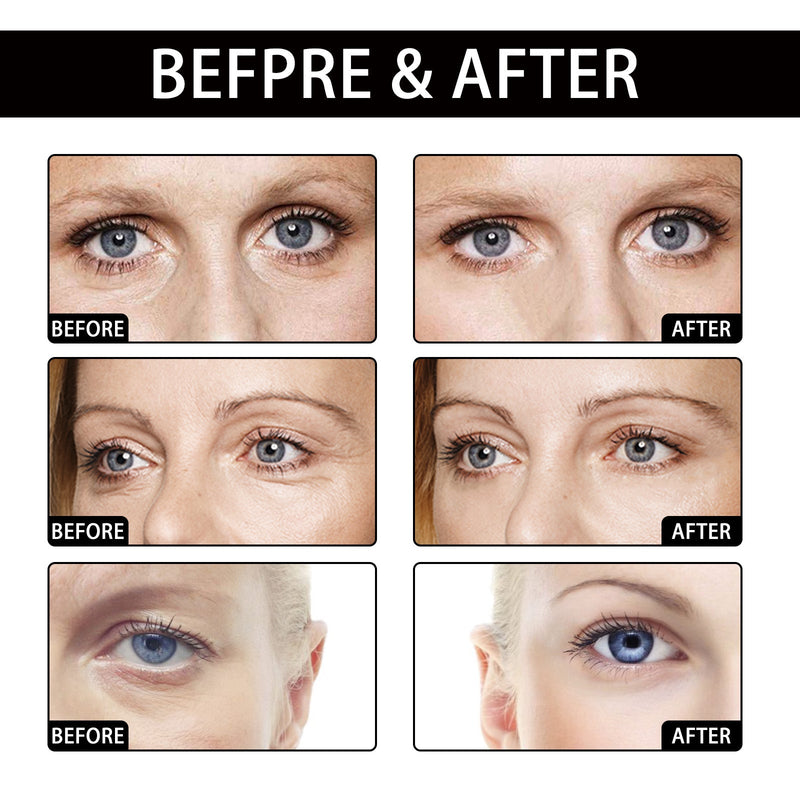 Coconut Eye Gel Patch Reduces Fine Lines Under Eyes, Dark Circles Under Eyes, Firming Eyes, Anti-Wrinkle Moisturizing Eye Patch
