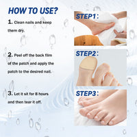 Fungal Nail Patches, Repair Thickening Gray Nail Rotten Nails Embedded Nails Soft Nails Bright Nails Toe Care