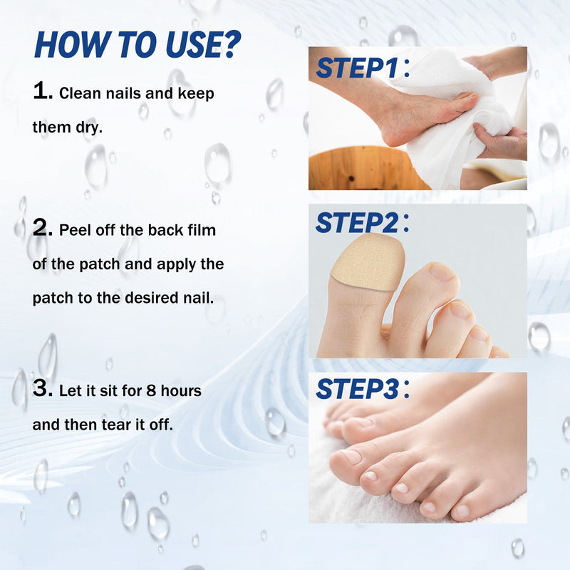 Fungal Nail Patches, Repair Thickening Gray Nail Rotten Nails Embedded Nails Soft Nails Bright Nails Toe Care