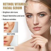 Retinol E Night Facial Essence, Brightening Skin, Moisturizing And Hydrating Essence