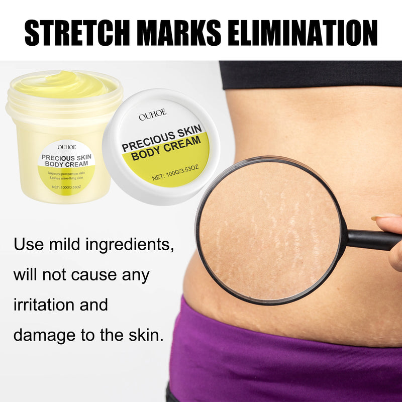 Ouhoe Pregnancy Care Cream Moisturizes And Restores Fine Lines Of Postpartum Skin To Firm, Soft And Smooth Body Skin